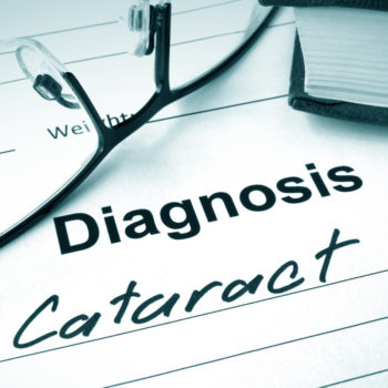 Debunking Common Myths About Cataracts