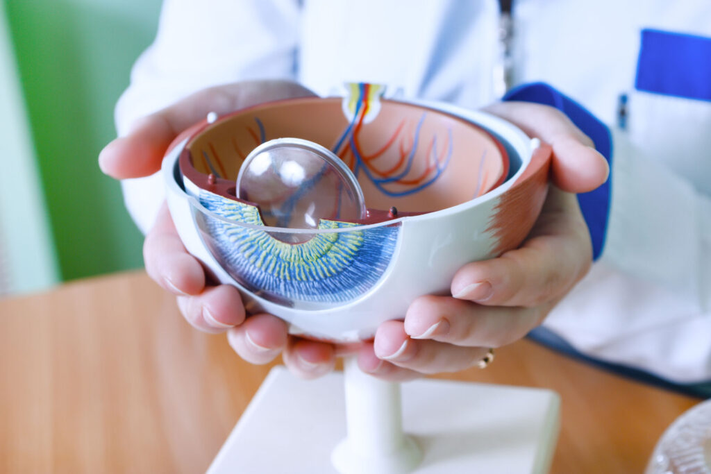 An ophthalmologist holds a model of a human eye. The top half of the eye has been removed to clearly show the model’s lens.