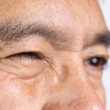 Is Eye Twitching Anything to Worry About? Ask a Macon Eye Doctor