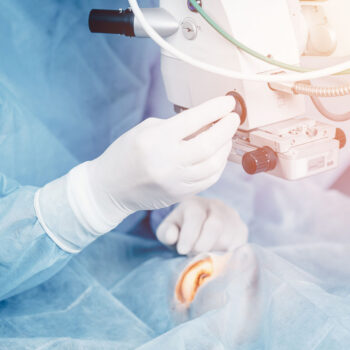 What Are the Risks of Cataract Surgery?