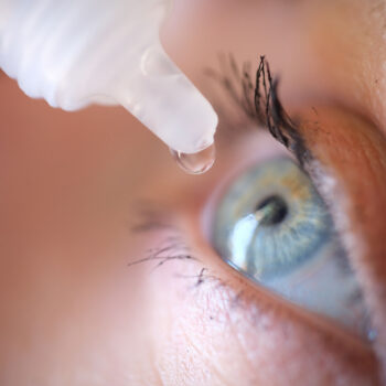 What Does Cataract Surgery Recovery Look Like?